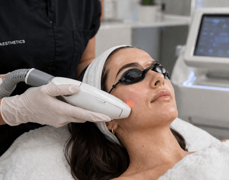 CO2 laser treatment CO2 laser treatment