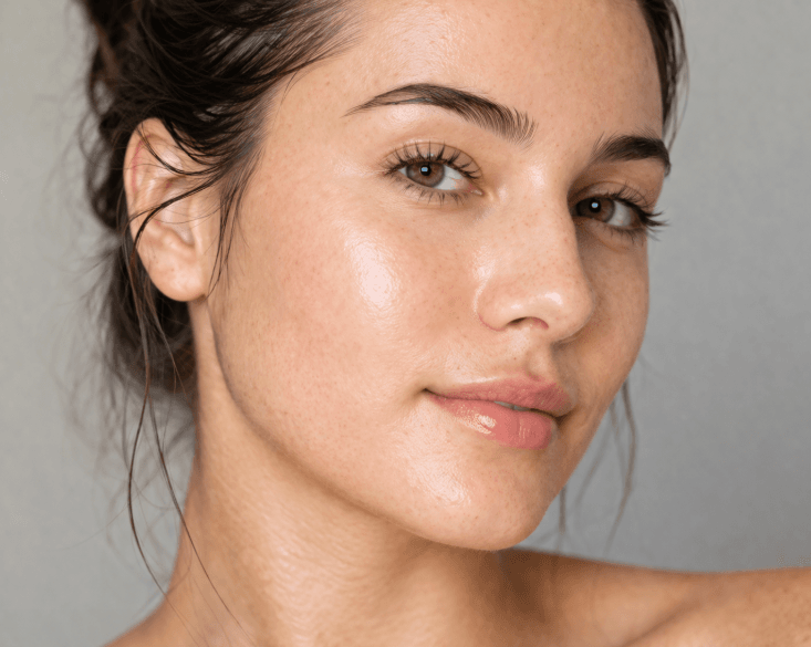 after microneedling