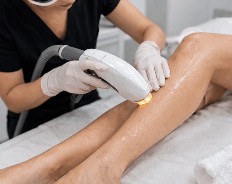laser hair removal laser hair removal