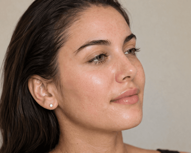results after laser treatment results after laser treatment